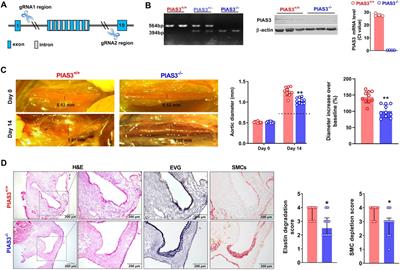 Genetic deficiency of protein inhibitor of activated STAT3 suppresses experimental abdominal aortic aneurysms